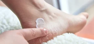 How Does Heel Balm Treat Cracked Heels?