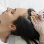 Advanced PRP Therapy Designed for Visible Hair Regrowth and Scalp Support
